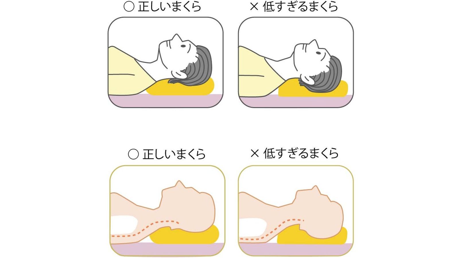 首寝違えの治療法5ステップを徹底解説！改善症例も含め、バランス整体大泉学園がお届け！ - バランス整体院 大泉学園バランス整体院 大泉学園